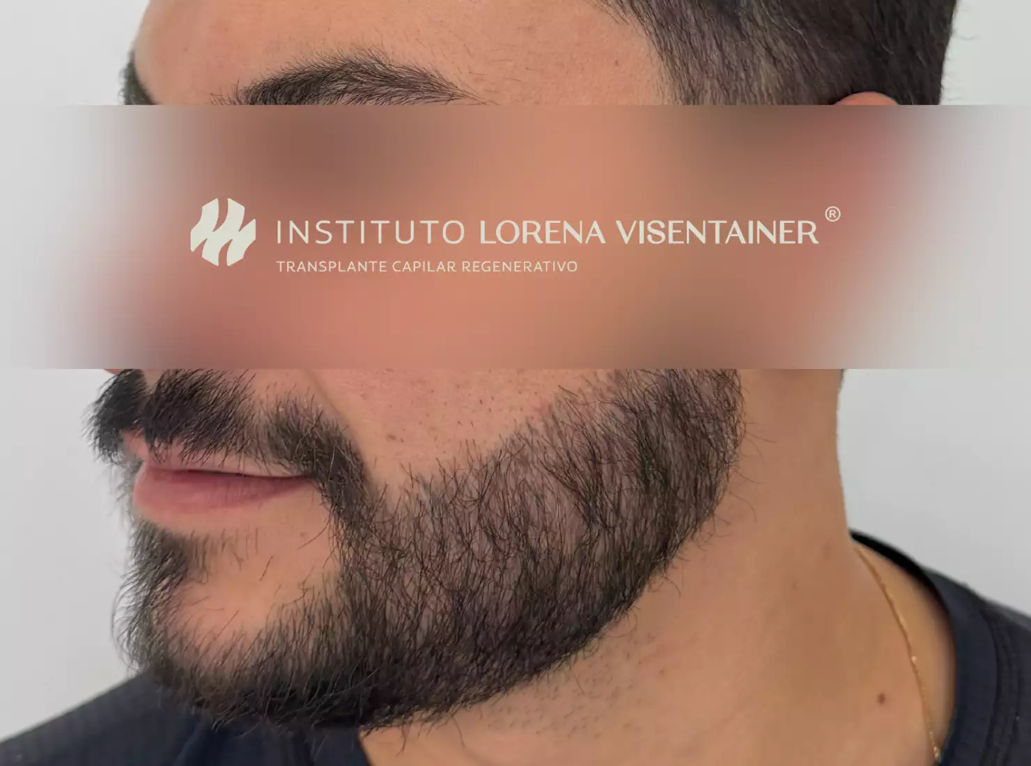 Depois
